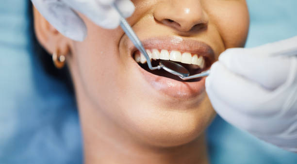 Best Pediatric Emergency Dentist in Fort Mill, SC